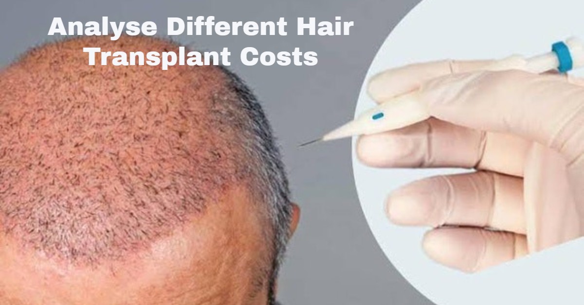 Analyse Different Hair Transplant Costs