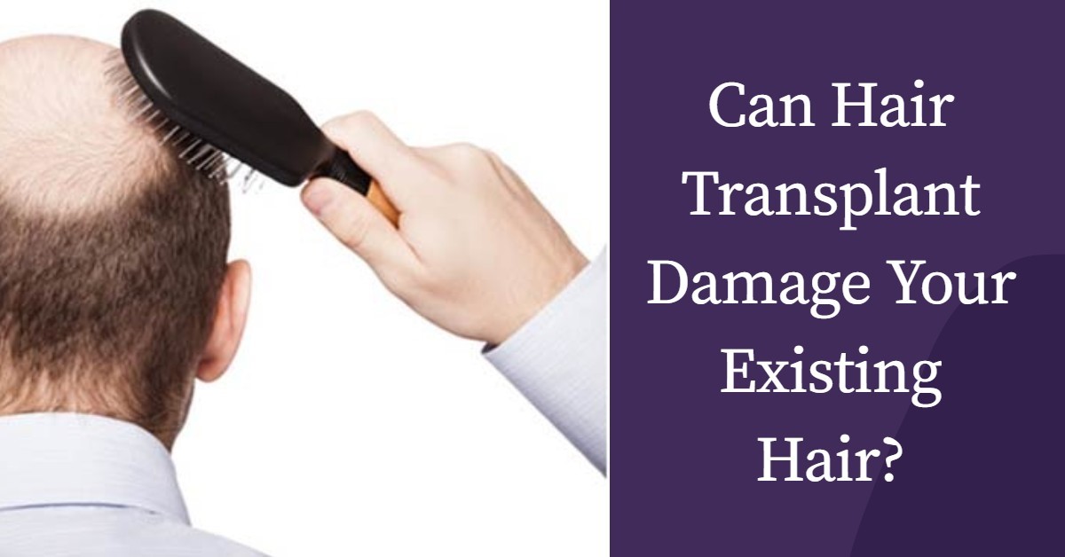 Can Hair Transplant Damage Your Existing Hair?