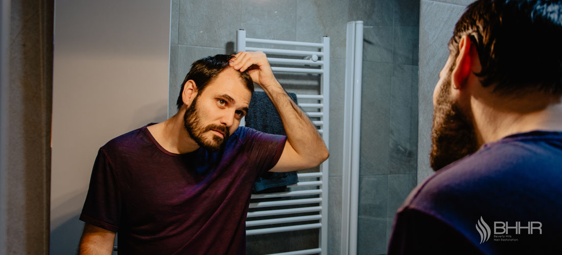 Balding:signs and prevention