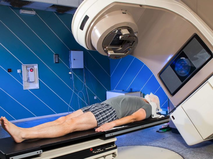 How Radiation therapy is Techpally with AI application