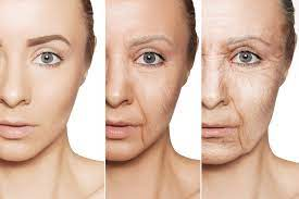 Anti wrinkle injections London