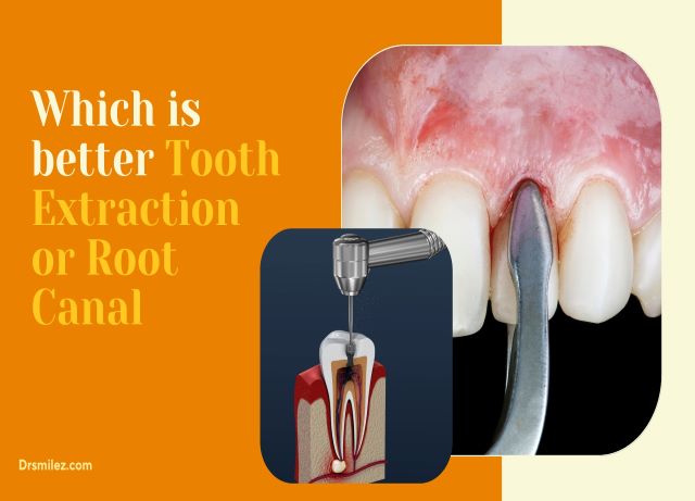 tooth extraction vs root canal
