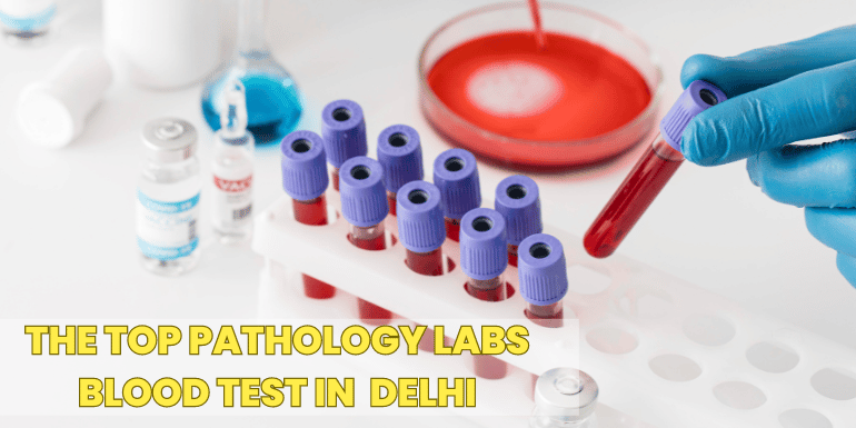 blood test at home delhi