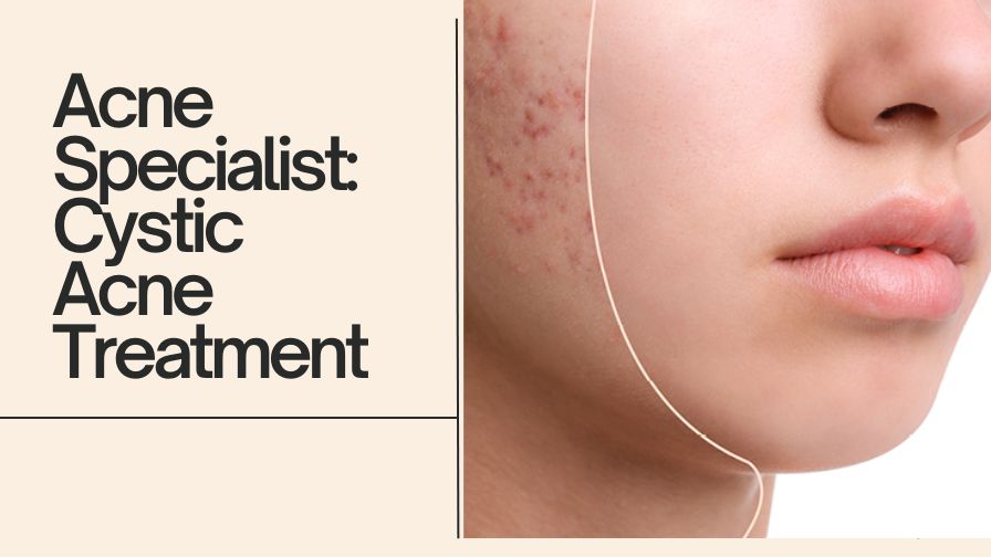 acne specialist