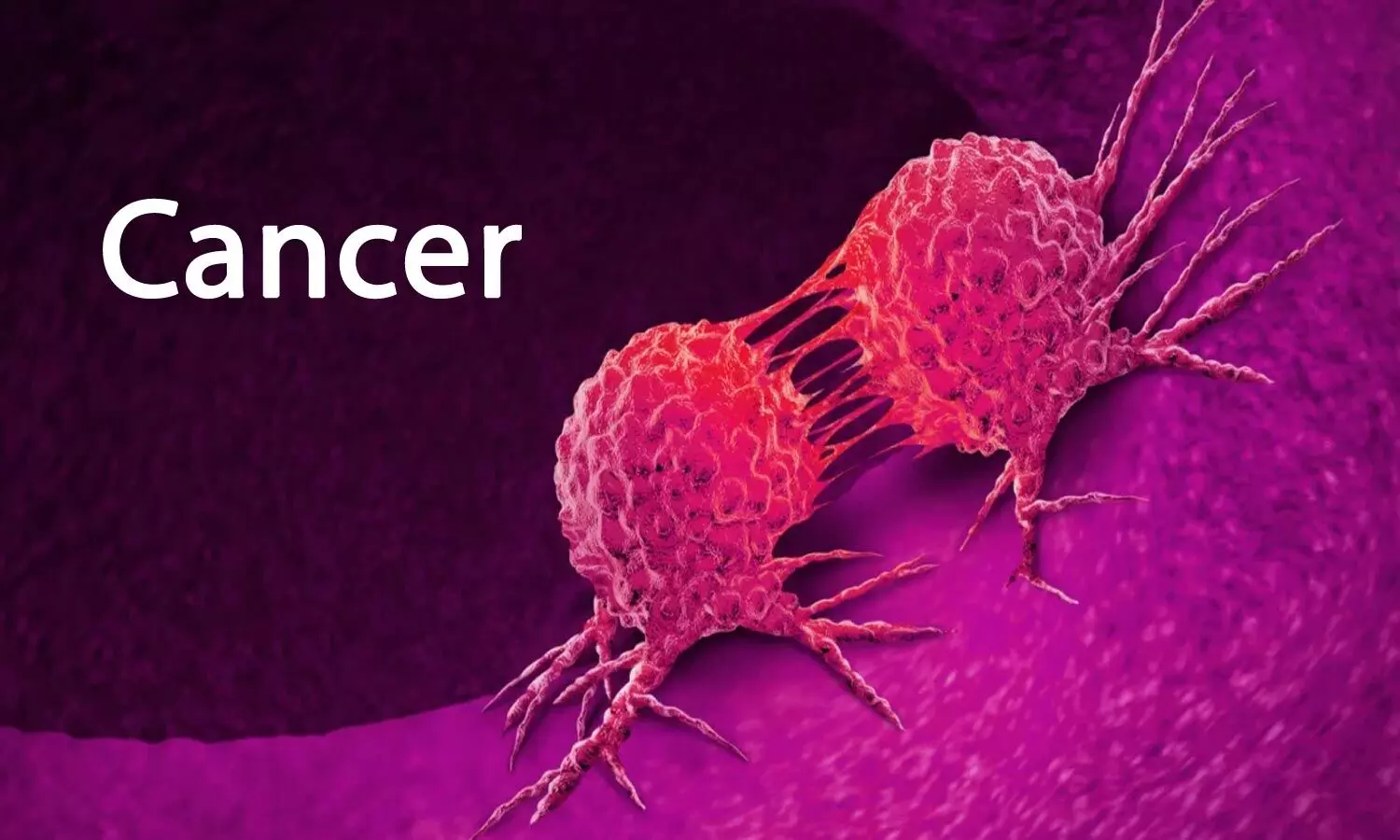 finest cancer treatment