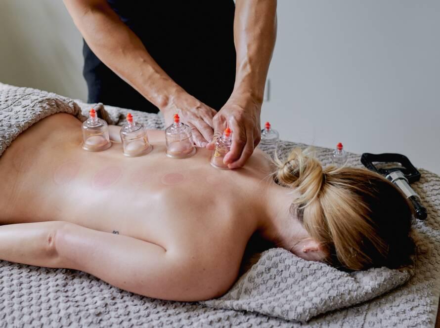 cupping therapy