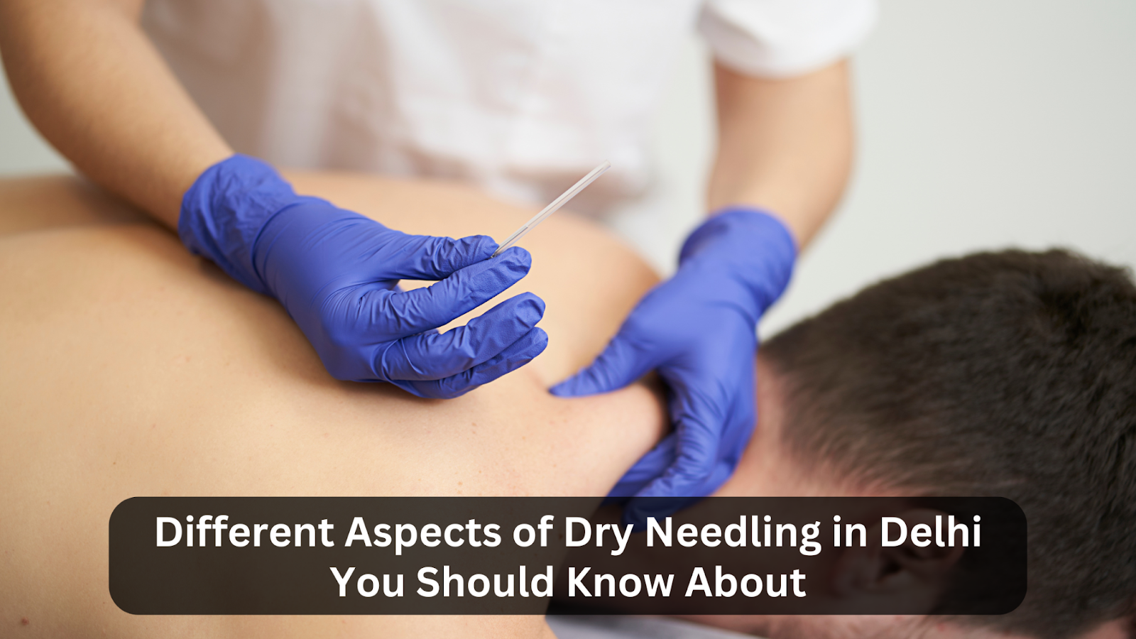 dry needling