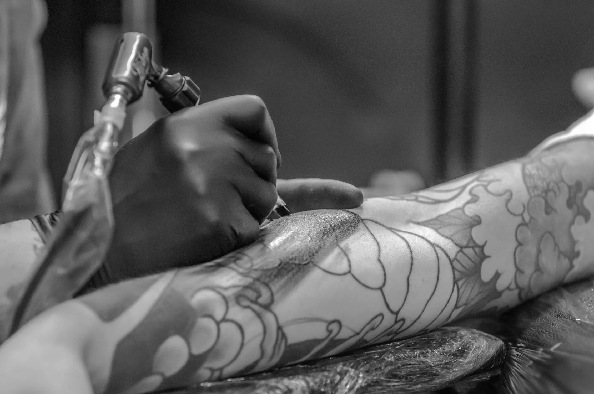 tattoo removal