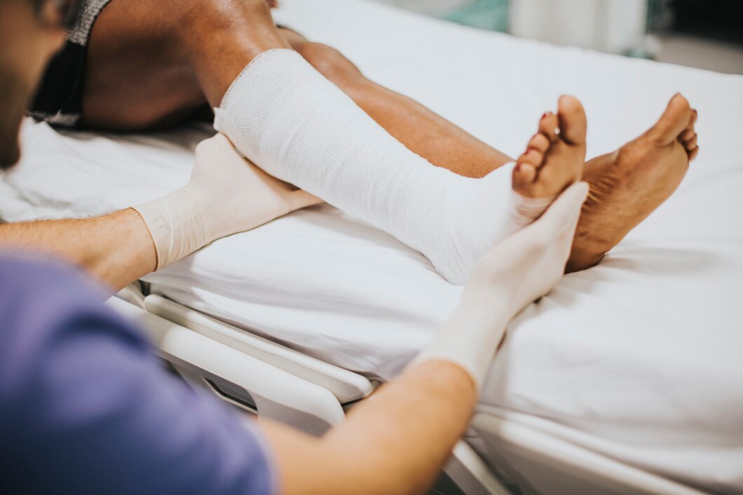ankle fracture