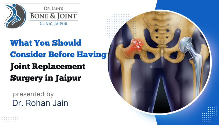 joint replacement surgery