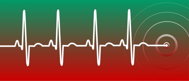 ai powered ecg analysis