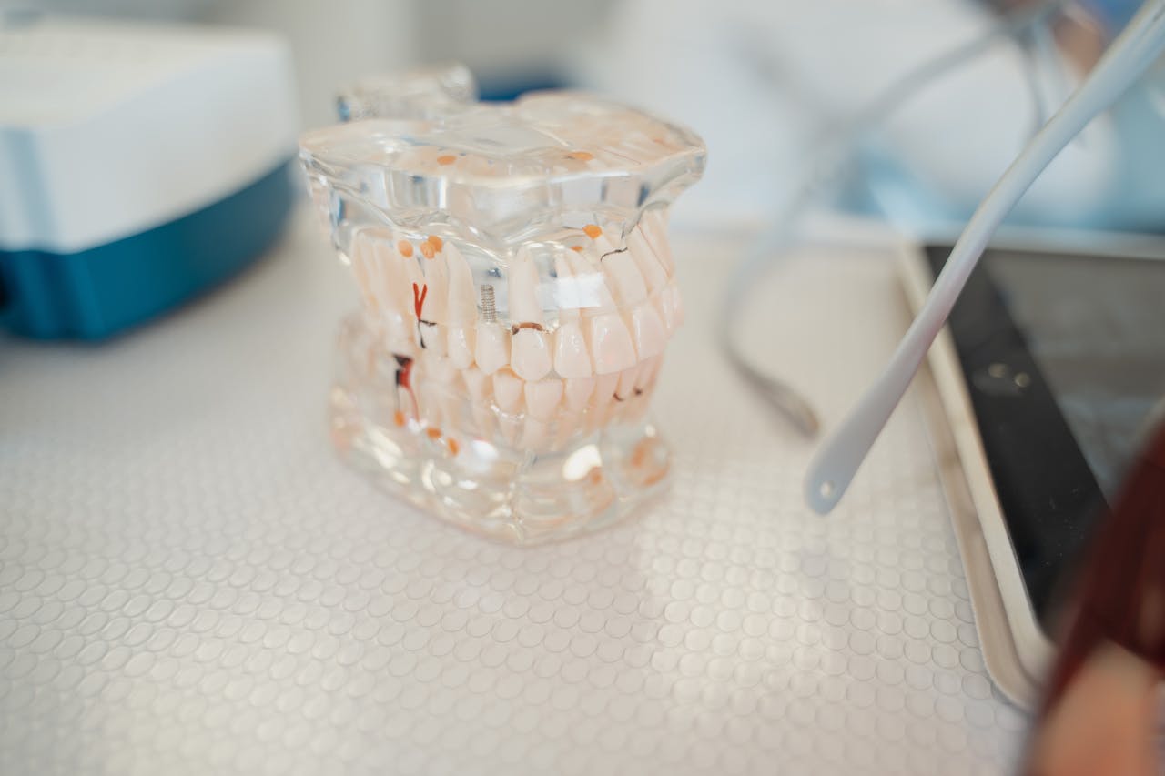 dental implants