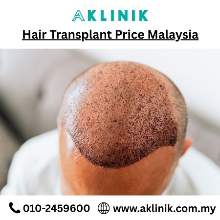 hair transplant price malaysia
