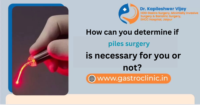 piles surgery necessary