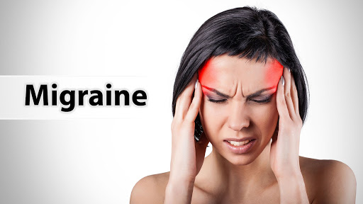 migraine treatment
