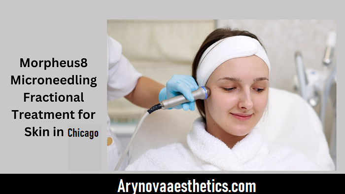 morpheus8 vs microneedling