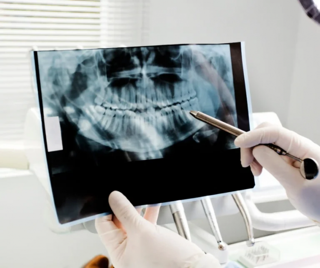 digital x ray tips