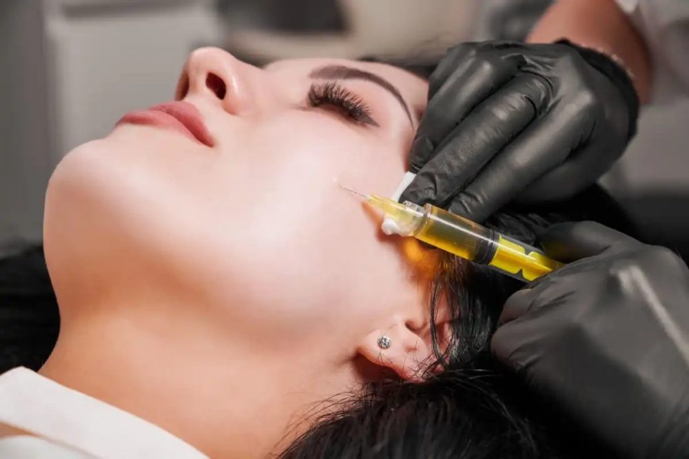 prp microneedling toronto